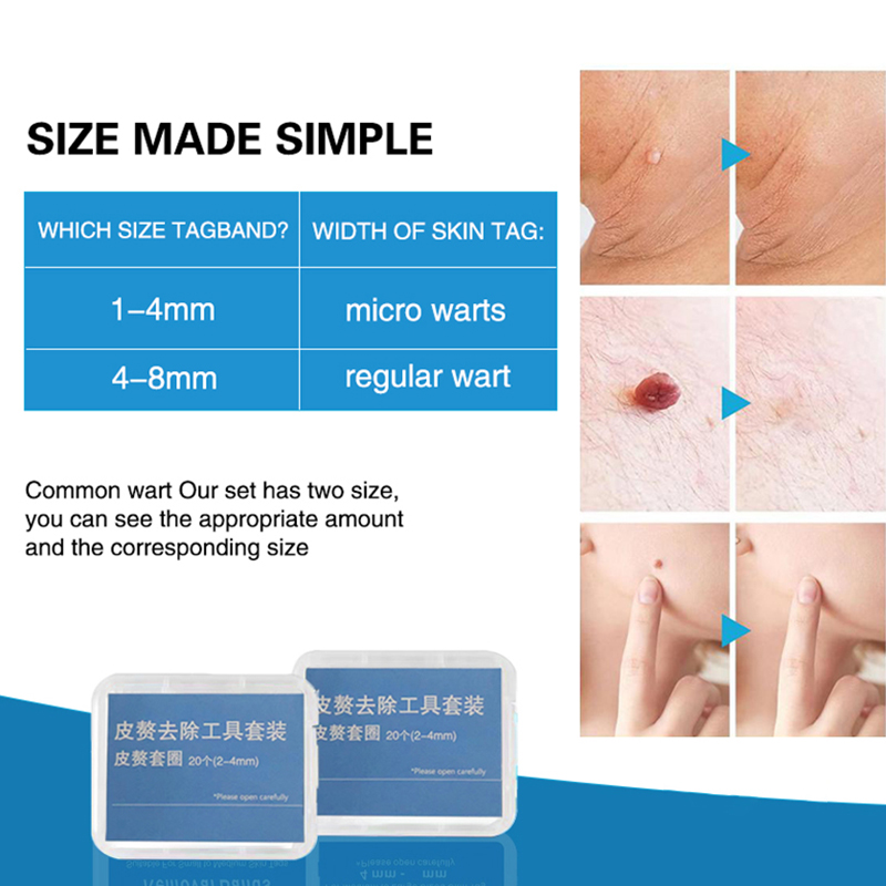 20pcs/Box Flesh Nevus Removal  - Power Tools Organizer ulasan dan harga